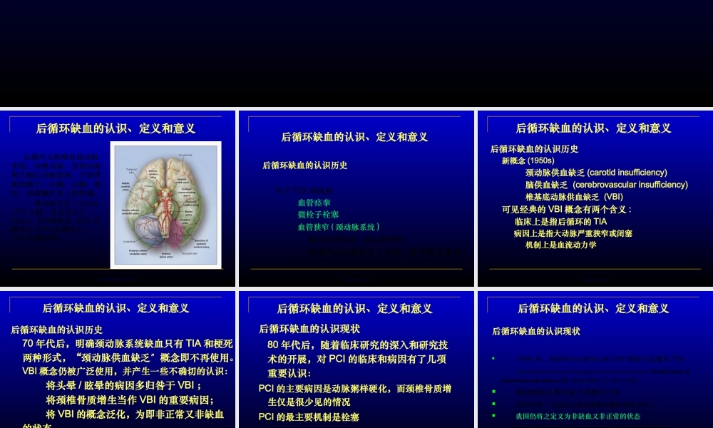 中国后循环缺血专家共识.pptx