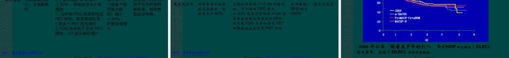 中国弥漫大B细胞淋巴瘤诊疗指南.ppt
