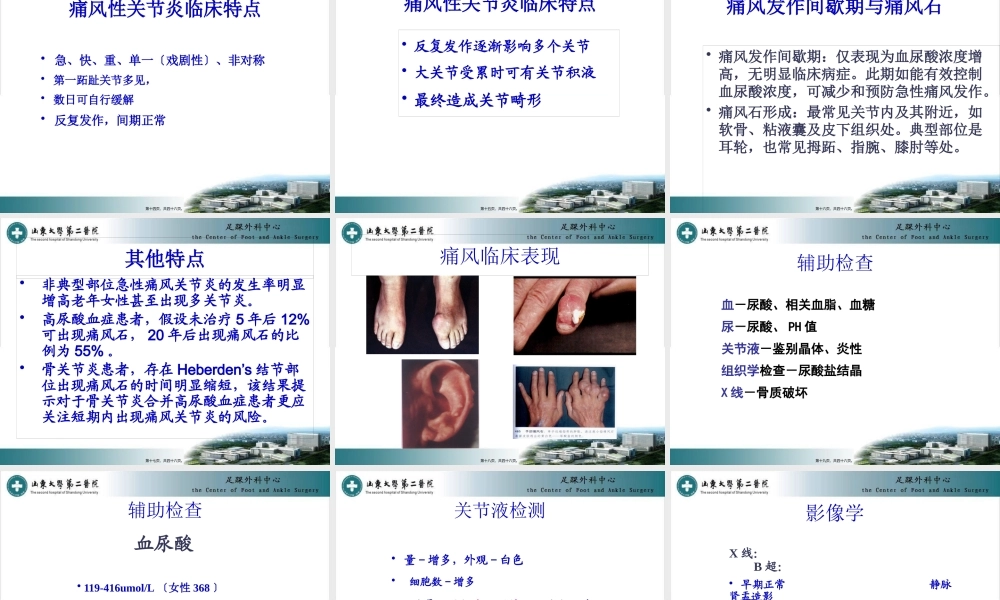 中国痛风诊疗指南.pptx