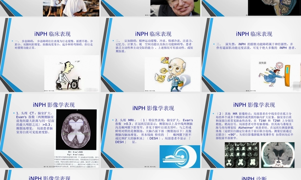 中国特发性正常压力脑积水诊治专家共识(2016).pptx