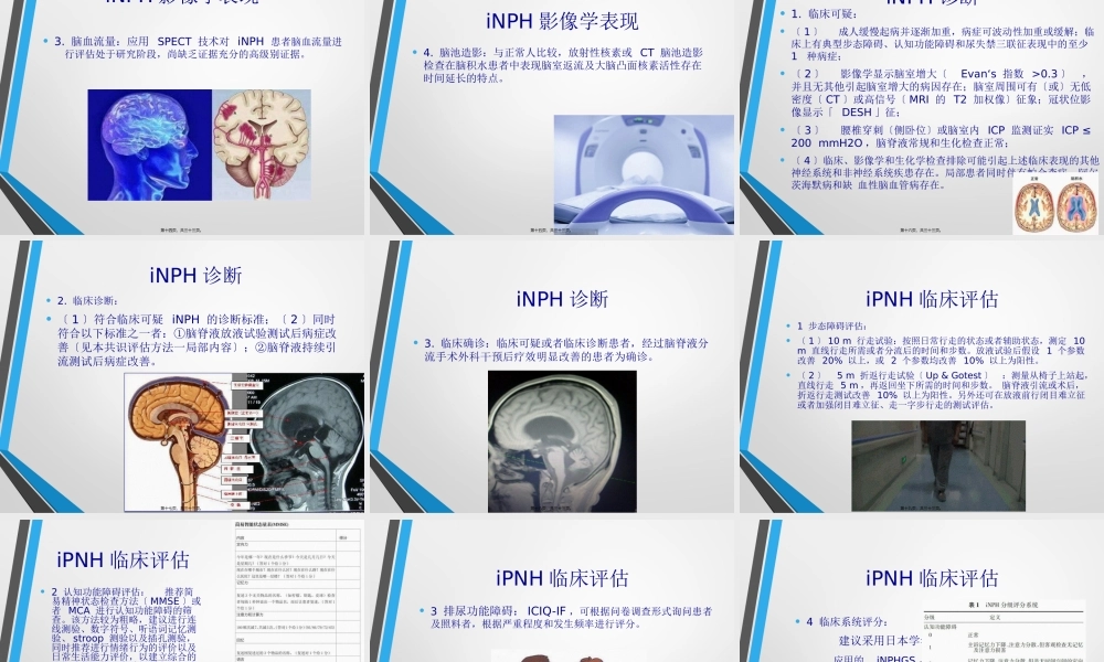 中国特发性正常压力脑积水诊治专家共识(2016).pptx