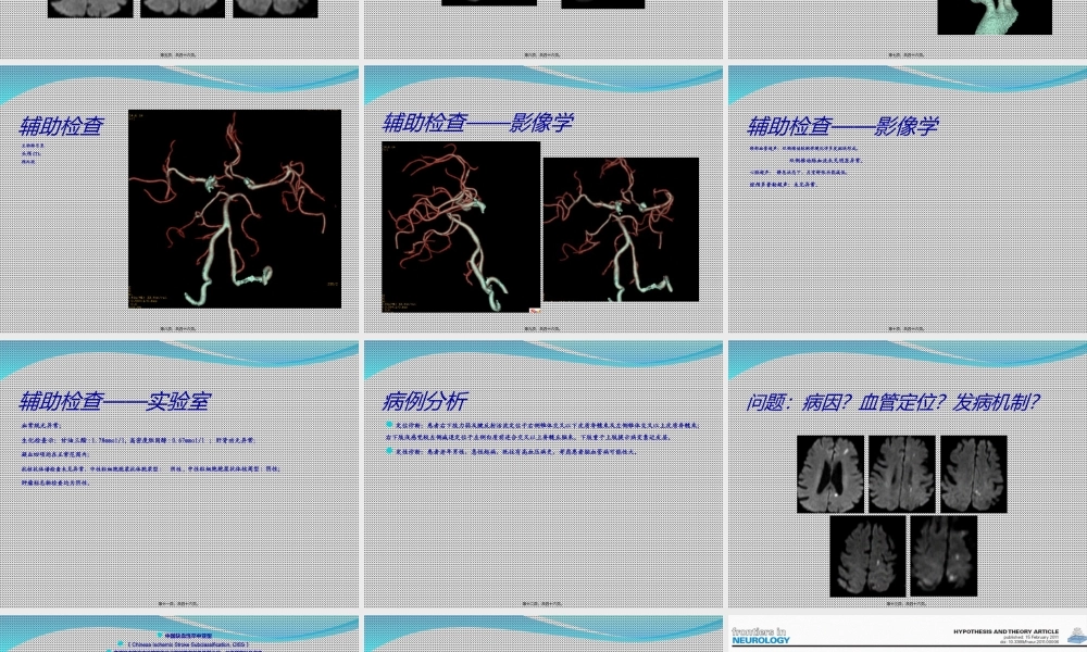 中国缺血性卒中亚型介绍.ppt