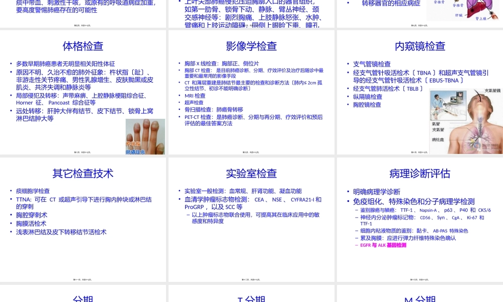 中国肺癌诊疗规范2015版解读.pptx