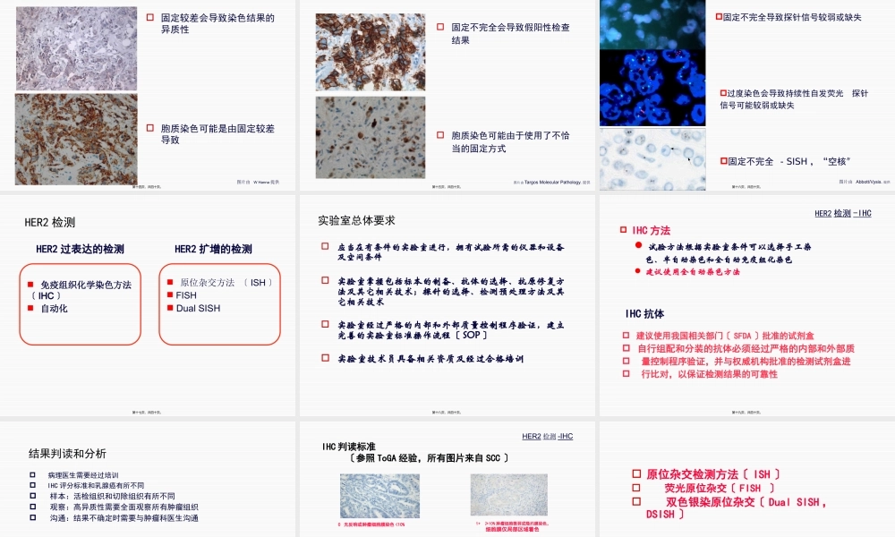 中国胃癌HER2检测-指南解读-郑杰.pptx