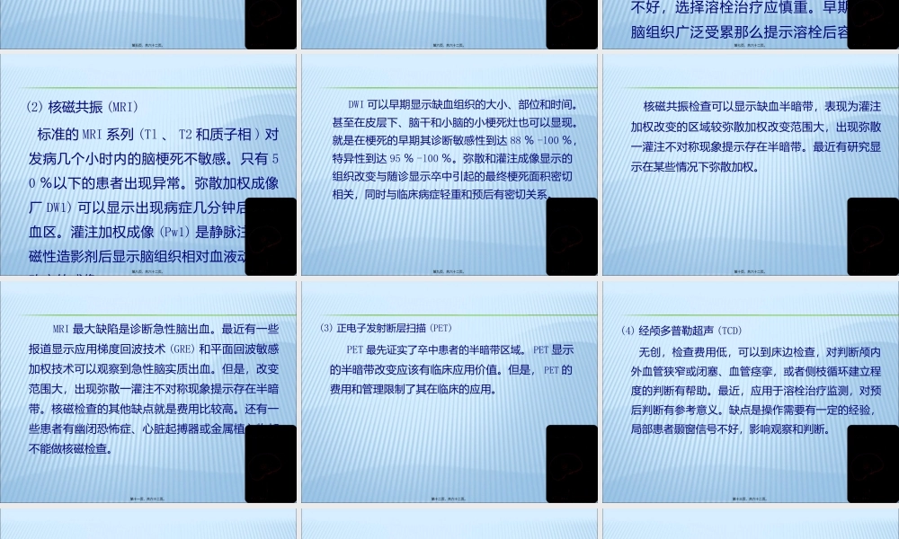 中国脑血管病防治指南解读.pptx