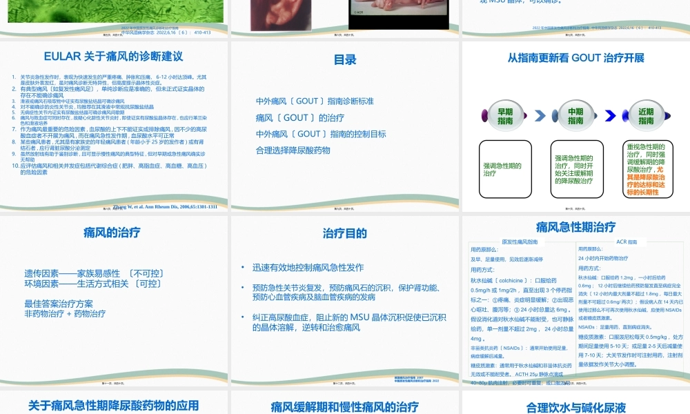 中外痛风指南解读.pptx