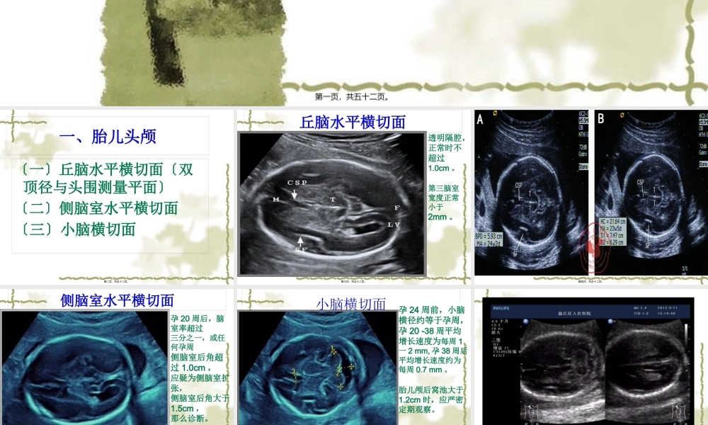 中孕期胎儿超声检查标准切面.pptx