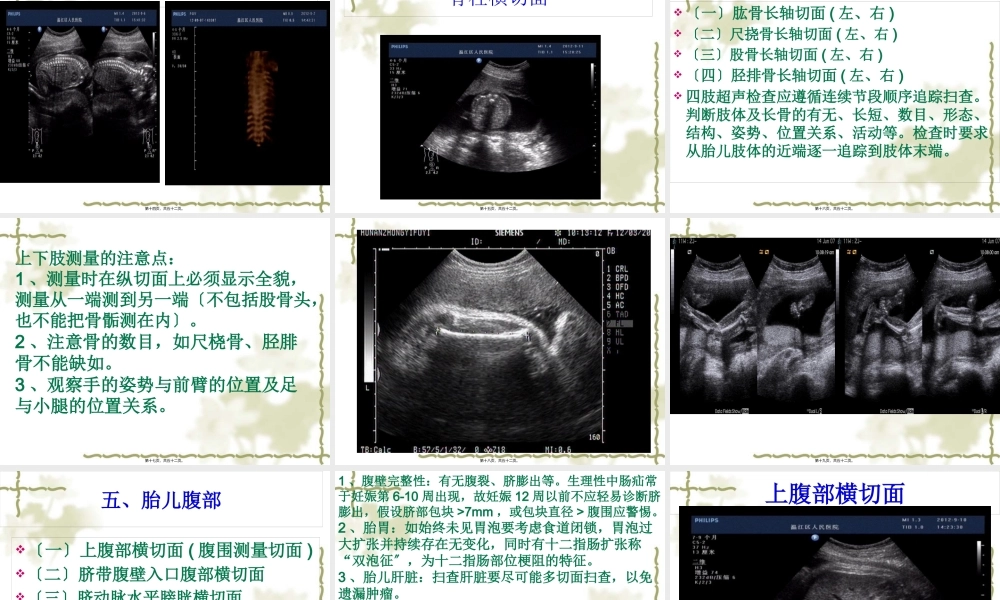 中孕期胎儿超声检查标准切面.pptx