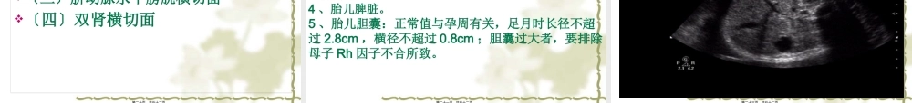 中孕期胎儿超声检查标准切面.pptx