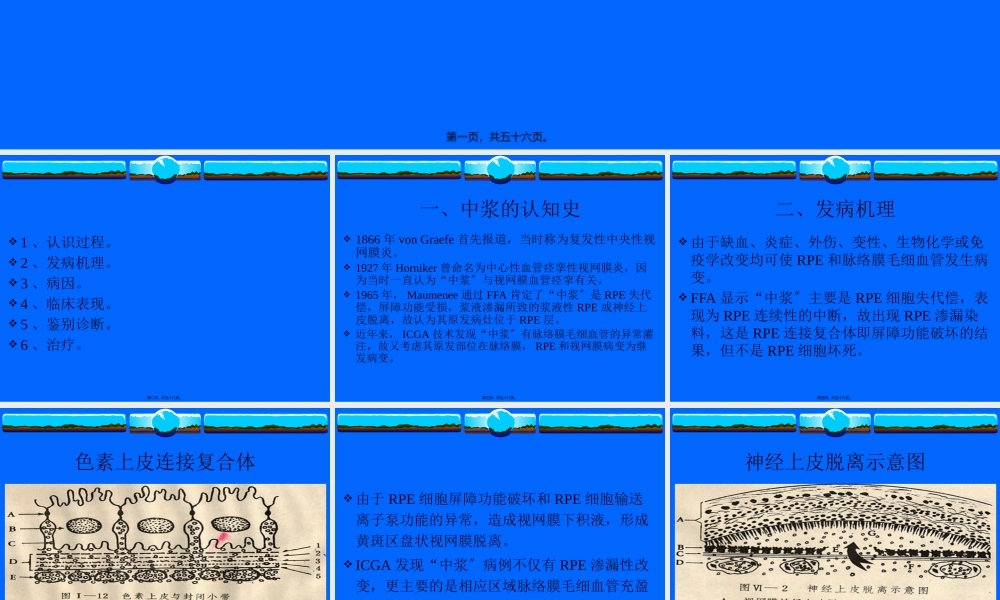 中心性浆液性脉络膜视网膜病变.pptx