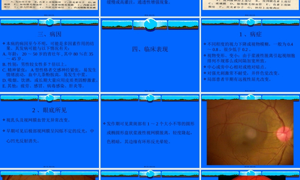 中心性浆液性脉络膜视网膜病变.pptx