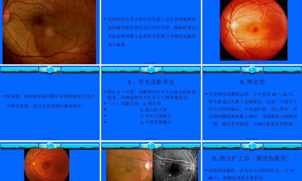 中心性浆液性脉络膜视网膜病变.pptx
