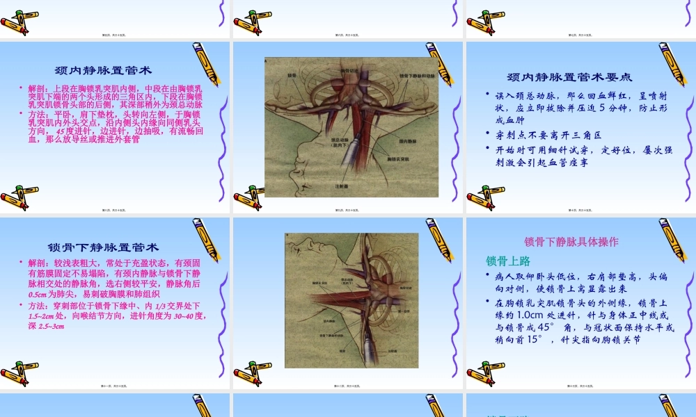 中心静脉置管在危重病.pptx