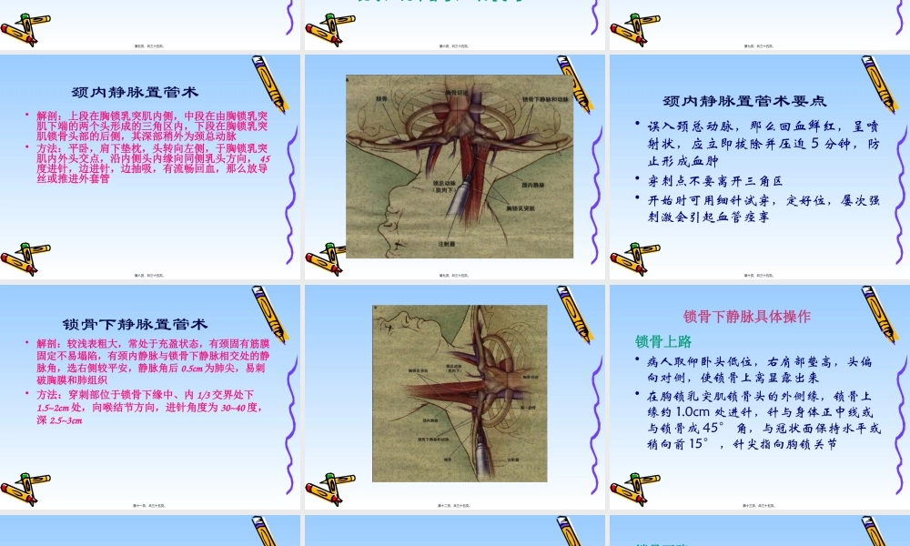 中心静脉置管技术在危重病研究.pptx