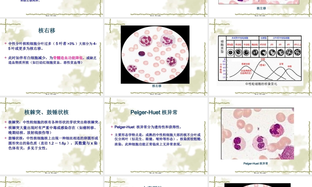 中性粒细胞形态异常剖析.pptx