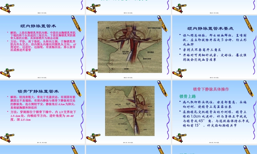 中心静脉置管技术在危重病(XLW)研究.pptx