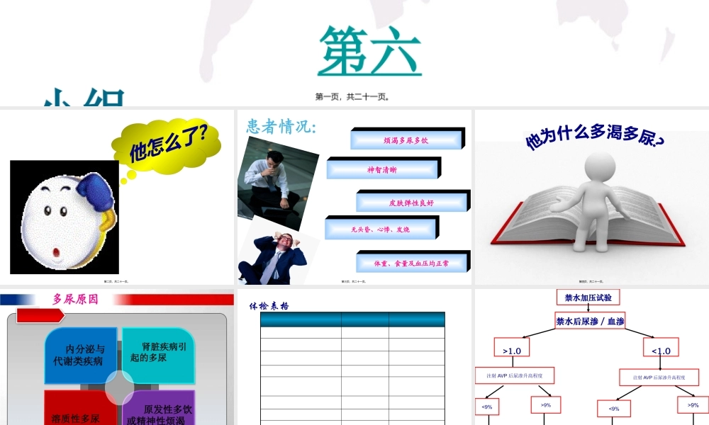 中枢性尿崩症Centraldiabetesinspidus.pptx