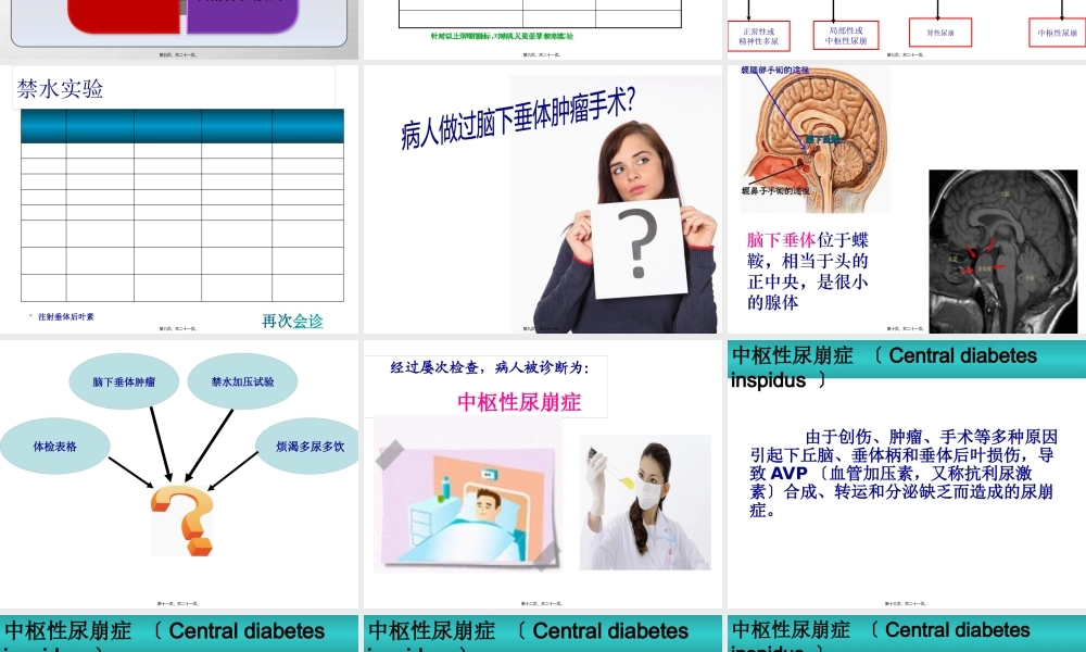 中枢性尿崩症Centraldiabetesinspidus.pptx