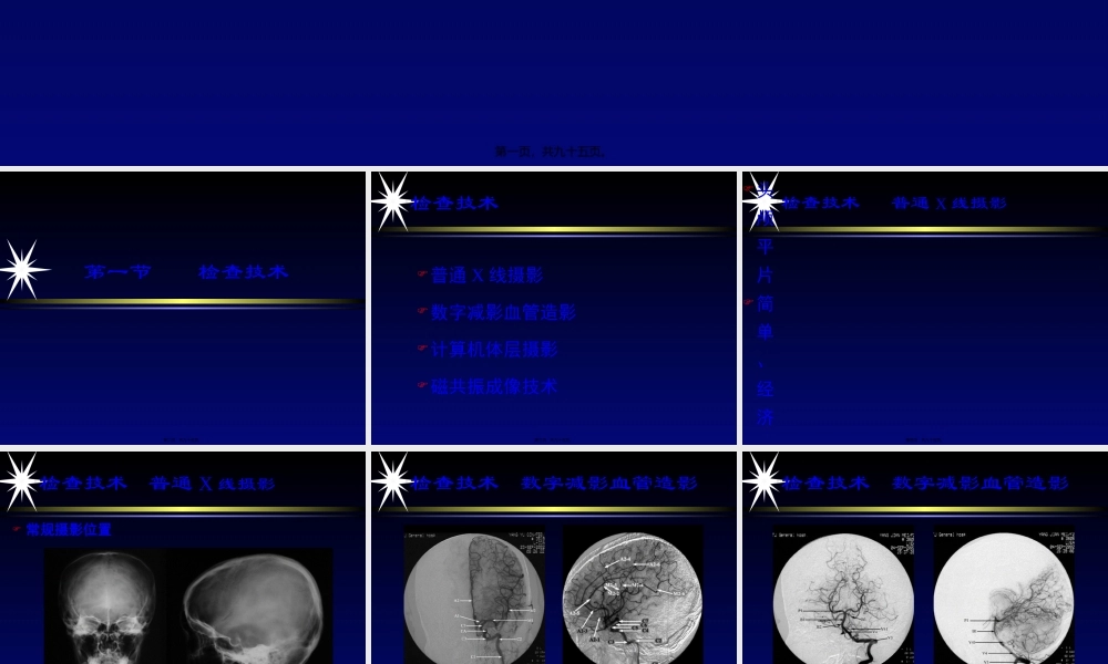 中枢神经系统影像学第一部分-2精讲.pptx