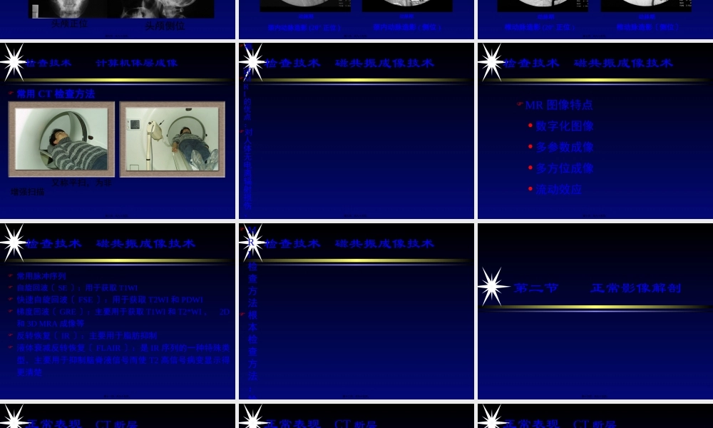中枢神经系统影像学第一部分-2精讲.pptx