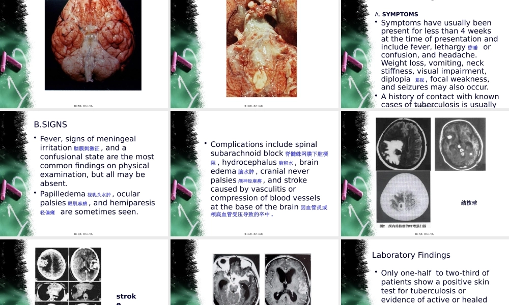 中枢神经系统感染-2.ppt.pptx