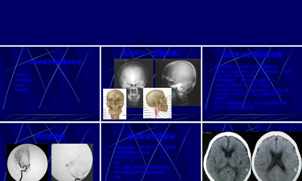 中枢神经系统正常及异常影像改变(北京协和医院).pptx