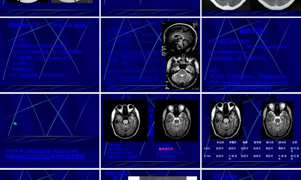 中枢神经系统正常及异常影像改变(北京协和医院).pptx