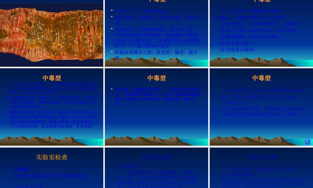 中毒性细菌性痢疾.pptx