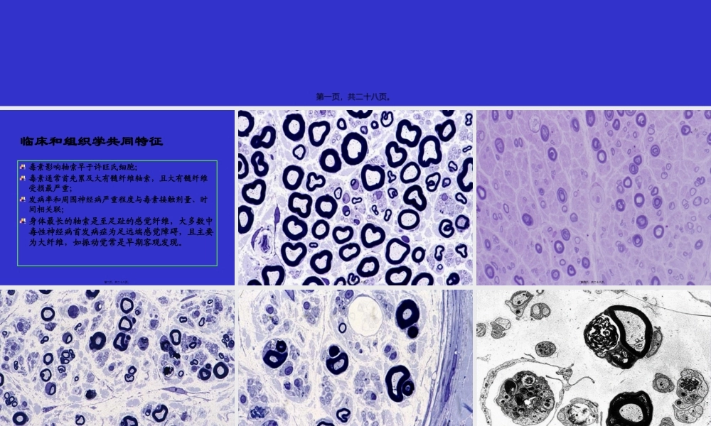 中毒性周围神经病.pptx