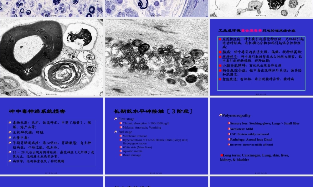 中毒性周围神经病.pptx