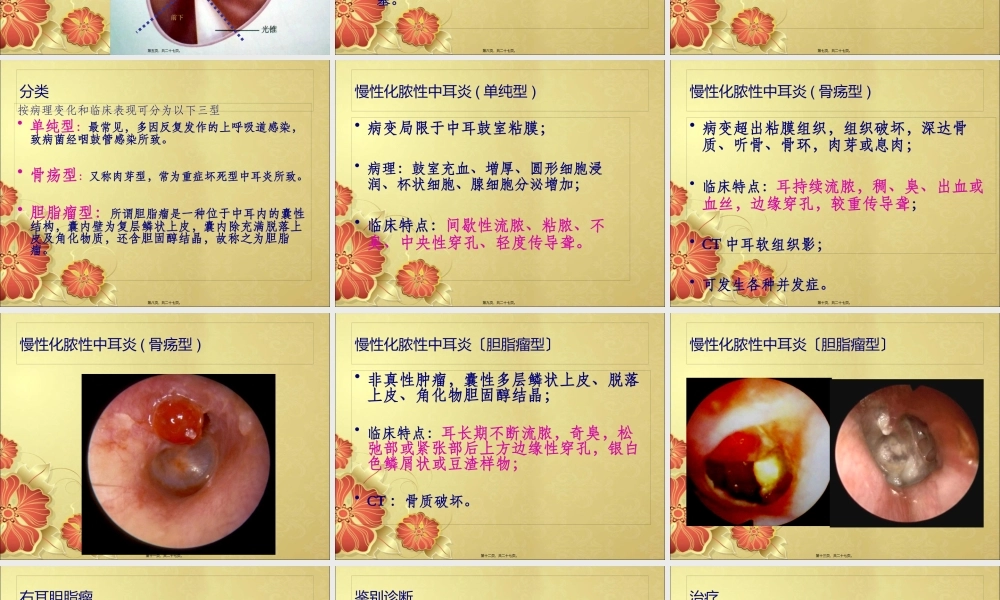 中耳炎-讲稿-2.pptx