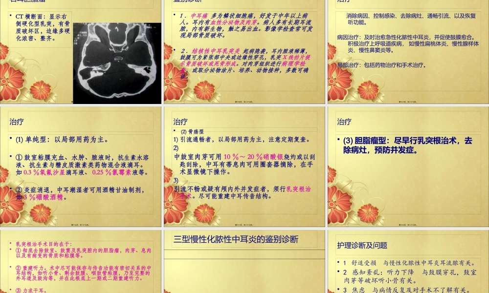 中耳炎-讲稿-2.pptx