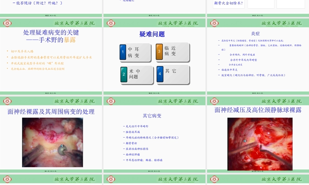 中耳手术疑难病变的处理心得.pptx