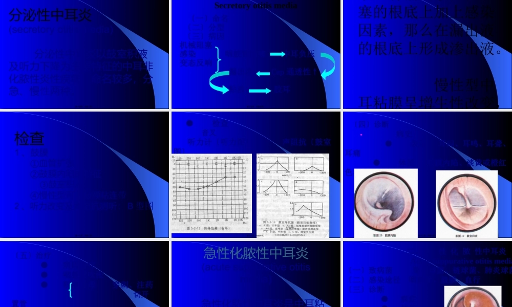 中耳炎及并发症.pptx