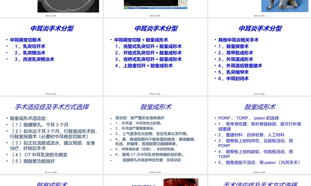 中耳炎规范化诊治思路.ppt