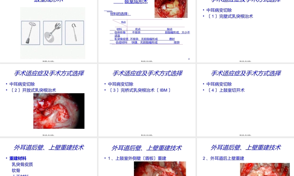 中耳炎规范化诊治思路.ppt
