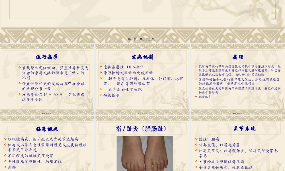 中西医结合骨伤-强直性脊柱炎.pptx