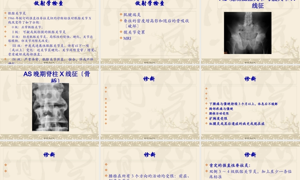 中西医结合骨伤-强直性脊柱炎.pptx