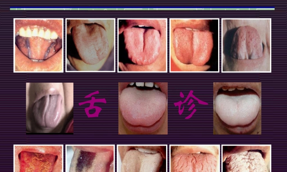 中诊--舌诊.pptx