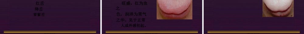 中诊--舌诊.pptx