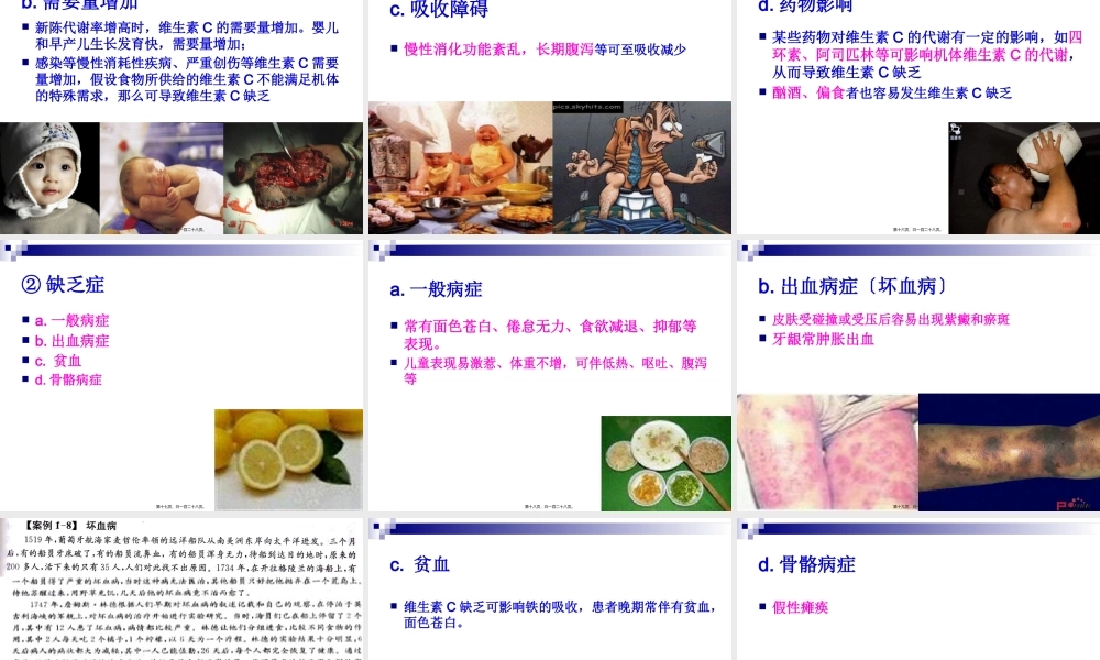 《烹饪营养学》第八讲-水溶性维生素.pptx