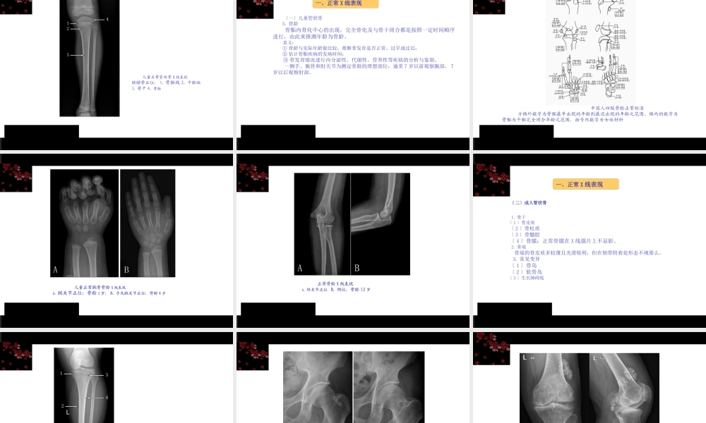 《骨伤科影像学》第一章总论.pptx