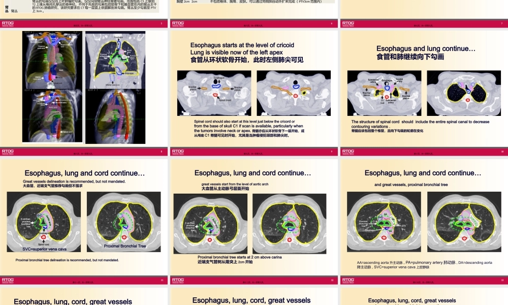 RTOG-放疗中胸部危及器官勾画-Organs-at-Risk-(OARs)-in-Thoracic.pptx