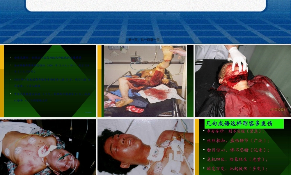严重多发伤紧急处理.pptx