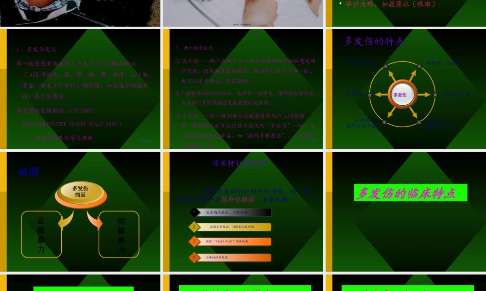 严重多发伤紧急处理.pptx