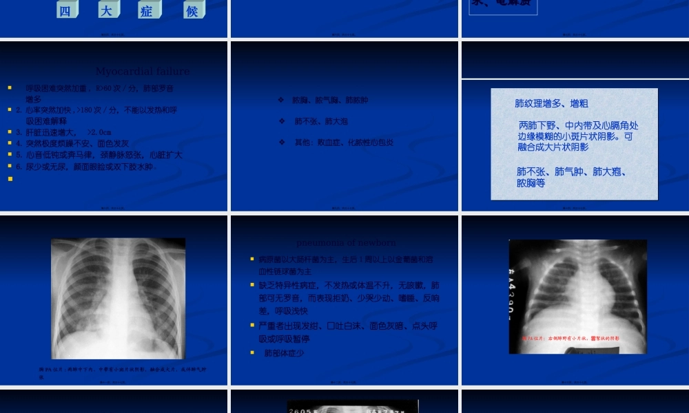 临-床-医-学-概-论.肺炎.pptx