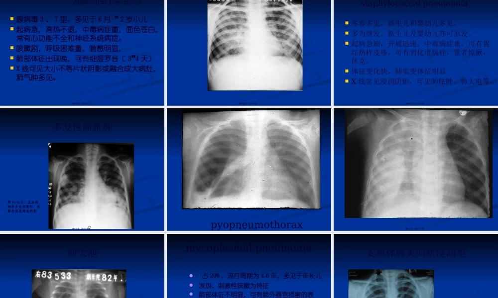 临-床-医-学-概-论.肺炎.pptx