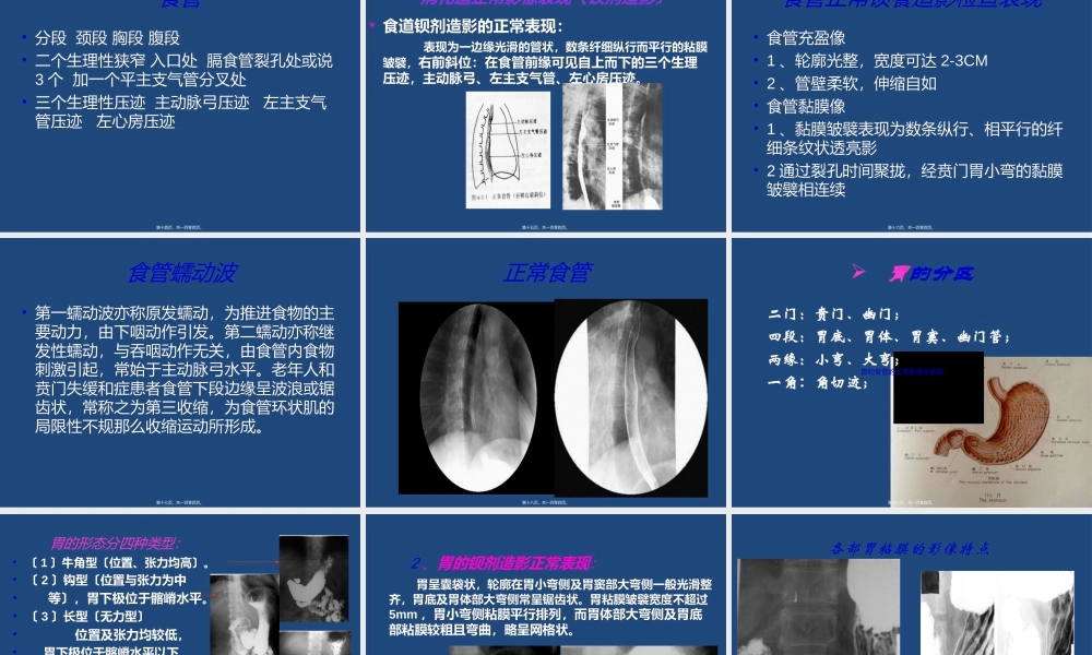 上消化道造影检查.ppt