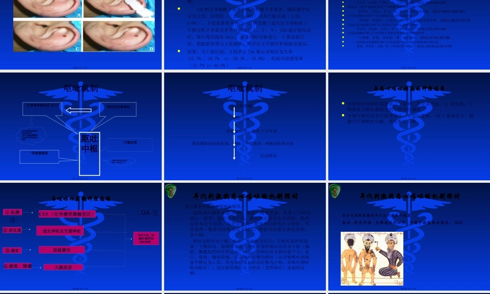 临沂.耳穴电刺激.pptx