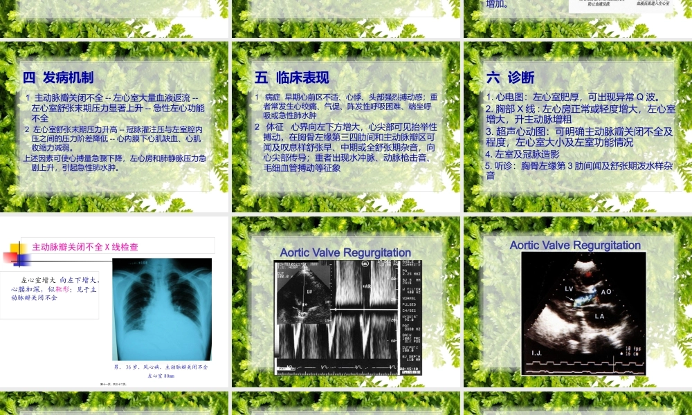 主动脉关闭不全..pptx